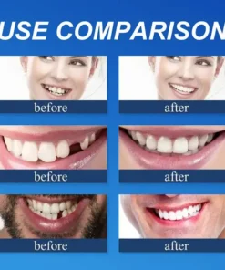 SEAGRIL™ --Advanced Customized Full Denture Set