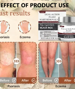 SEAGRIL™ 𝐁𝐥𝗮𝐜𝐤 𝐑𝐢𝐜𝗲 𝐒𝐤𝗶𝐧 𝐑𝗲𝐩𝐚𝗶𝐫 𝐄𝐬𝐬𝗲𝐧𝐜𝐞 𝐂𝐫𝗲𝗮𝐦