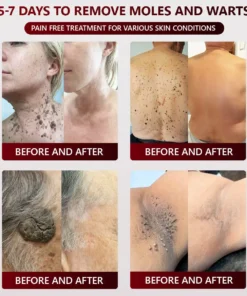 SEAGRIL™ 𝐁𝐥𝗮𝐜𝐤 𝐑𝐢𝐜𝗲 𝐒𝐤𝗶𝐧 𝐑𝗲𝐩𝐚𝗶𝐫 𝐄𝐬𝐬𝗲𝐧𝐜𝐞 𝐂𝐫𝗲𝗮𝐦