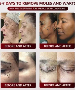 SEAGRIL™ 𝐁𝐥𝗮𝐜𝐤 𝐑𝐢𝐜𝗲 𝐒𝐤𝗶𝐧 𝐑𝗲𝐩𝐚𝗶𝐫 𝐄𝐬𝐬𝗲𝐧𝐜𝐞 𝐂𝐫𝗲𝗮𝐦