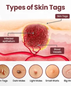 SEAGRIL™ 𝐁𝐥𝗮𝐜𝐤 𝐑𝐢𝐜𝗲 𝐒𝐤𝗶𝐧 𝐑𝗲𝐩𝐚𝗶𝐫 𝐄𝐬𝐬𝗲𝐧𝐜𝐞 𝐂𝐫𝗲𝗮𝐦