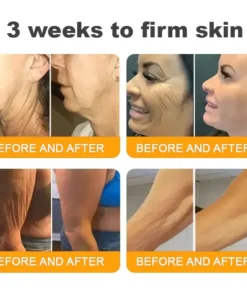 SEAGRIL™ Bee Venom Skin Restoration Cream