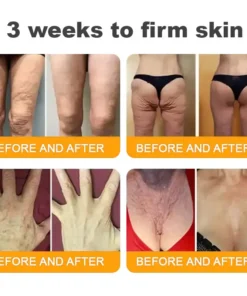 SEAGRIL™ Bee Venom Skin Restoration Cream