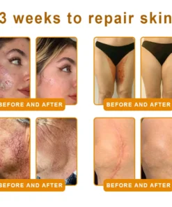 SEAGRIL™ Bee Venom Skin Restoration Cream