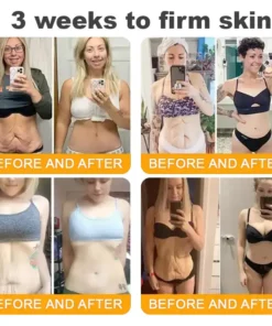 SEAGRIL™ Bee Venom Skin Restoration Cream