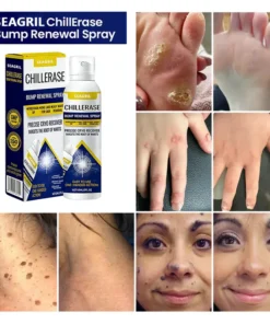 SEAGRIL™ ChillErase Bump Renewal Spray