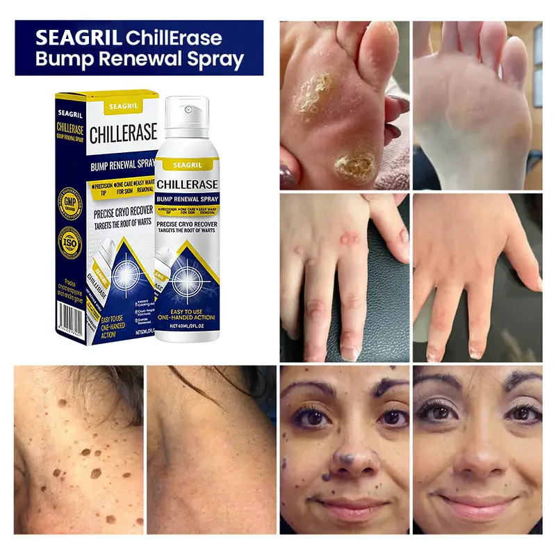 SEAGRIL™ ChillErase Bump Renewal Spray