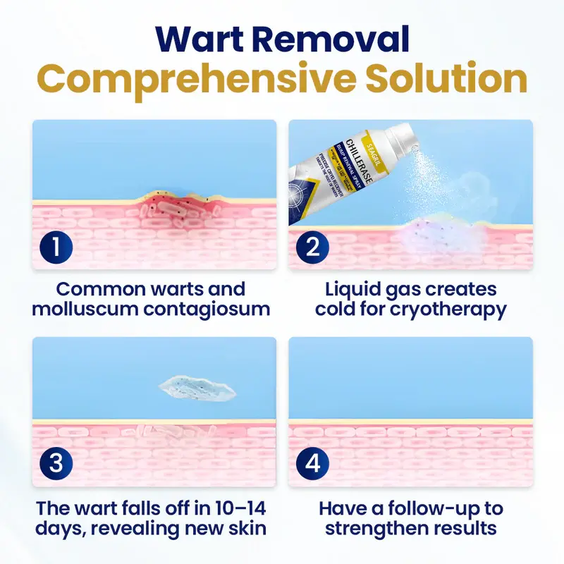 SEAGRIL™ ChillErase Bump Renewal Spray