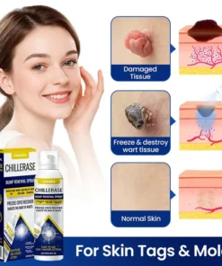 SEAGRIL™ ChillErase Bump Renewal Spray