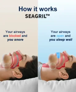 SEAGRIL™ Professional intelligent anti-snoring device