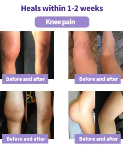 SEAGRIL™ Turmeric Emu Oil Arthritis Relief and Pain Relief Massage Gel Certified by the American Osteopathic Association (AOA)