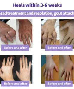 SEAGRIL™ Turmeric Emu Oil Arthritis Relief and Pain Relief Massage Gel Certified by the American Osteopathic Association (AOA)