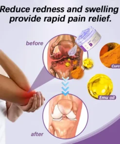 SEAGRIL™ Turmeric Emu Oil Arthritis Soothing Pain Relief Massage Gel American Osteopathic Association (AOA) Approved