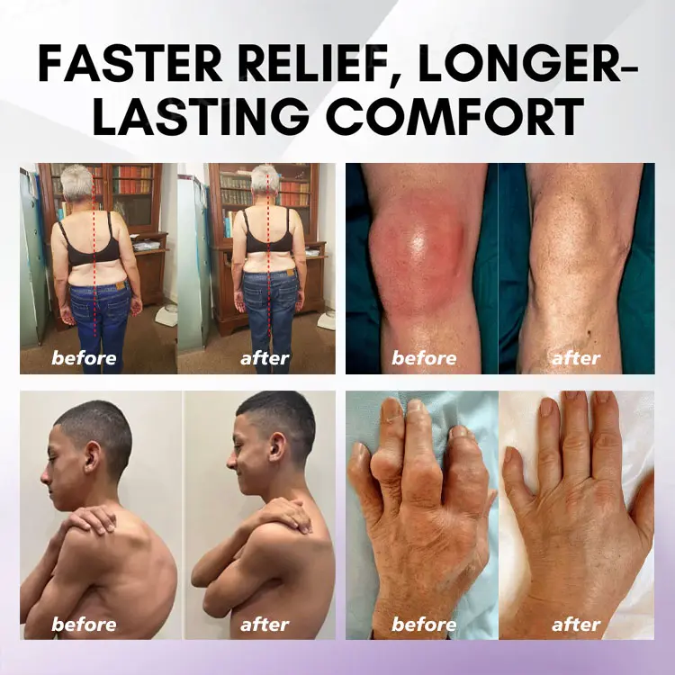 SEAGRIL™ Turmeric Emu Oil Arthritis Soothing Pain Relief Massage Gel American Osteopathic Association (AOA) Approved