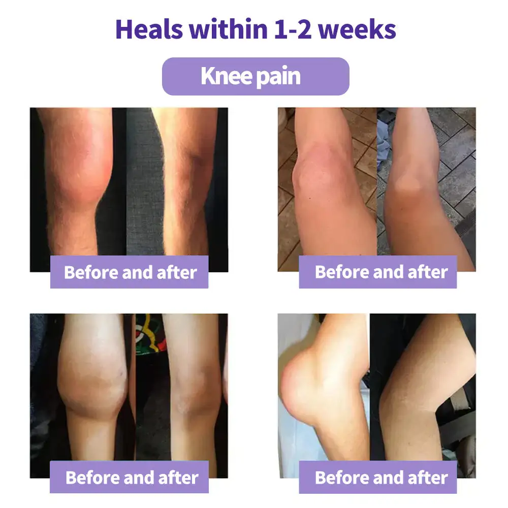 SEAGRIL™ Turmeric Emu Oil Arthritis Soothing Pain Relief Massage Gel American Osteopathic Association (AOA) Approved