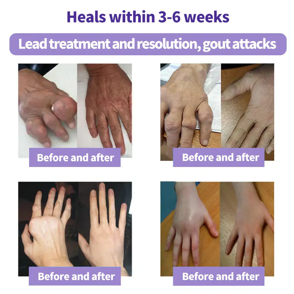 SEAGRIL™ Turmeric Emu Oil Arthritis Soothing Pain Relief Massage Gel American Osteopathic Association (AOA) Approved