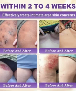 SEAGRIL® Biotin 10-in-1 Skin Restoration Cream