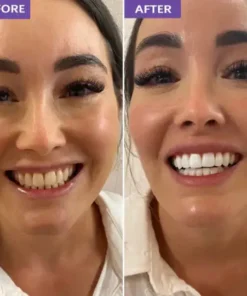 SEAGRIL™ Novora Purple Teeth Whitening Strips