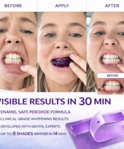 SEAGRIL™ Novora Purple Teeth Whitening Strips
