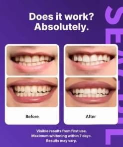 SEAGRIL™ Novora Purple Teeth Whitening Strips
