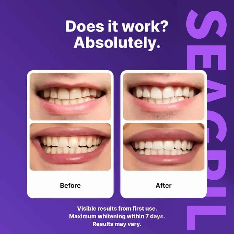 SEAGRIL™ Purple Teeth Whitening Strips 7/21 Treatments Peroxide-Free Enamel Safe No Tooth Sensitivity
