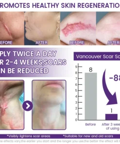 Seagril® ReGenScar Stem Cell Scar Gel