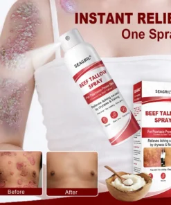 SEAGRIL® Beef Tallow Spray for Itchy, Flaky Psoriasis Skin