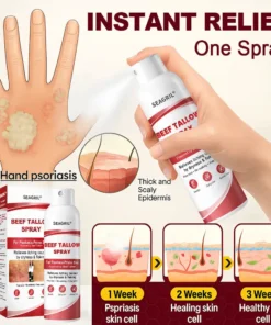 SEAGRIL® Beef Tallow Spray for Itchy, Flaky Psoriasis Skin