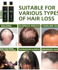 SEAGRIL® Organic Rosemary Hair Growth Shampoo
