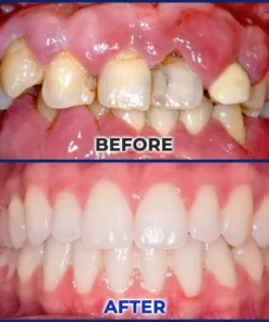 SEAGRIL® Repair Solution
