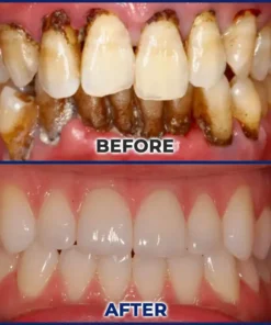 SEAGRIL® Repair Solution