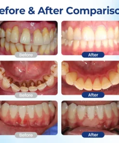 SEAGRIL® Repair Solution