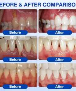 SEAGRIL ® Gum health Periodontal Repair Gel