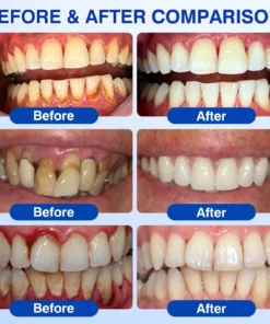 SEAGRIL ® Gum health Periodontal Repair Gel