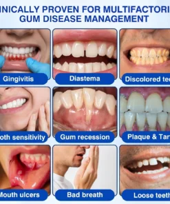 SEAGRIL ® Gum health Periodontal Repair Gel