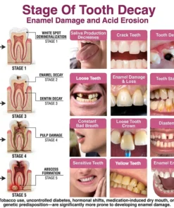 SEAGRIL® DenPerm Cavity-Repair Natural Enamel Filling Gel